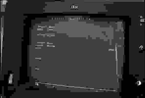 Border control investigation.<br />
Spielfeld, 1983<br />
