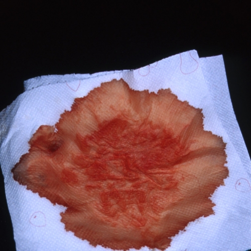 Full text in English